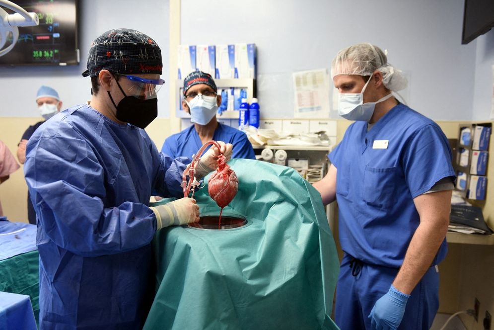 Pertama Kali! Tim Dokter Amerika Berhasil Lakukan Transplantasi Jantung Babi ke Manusia 